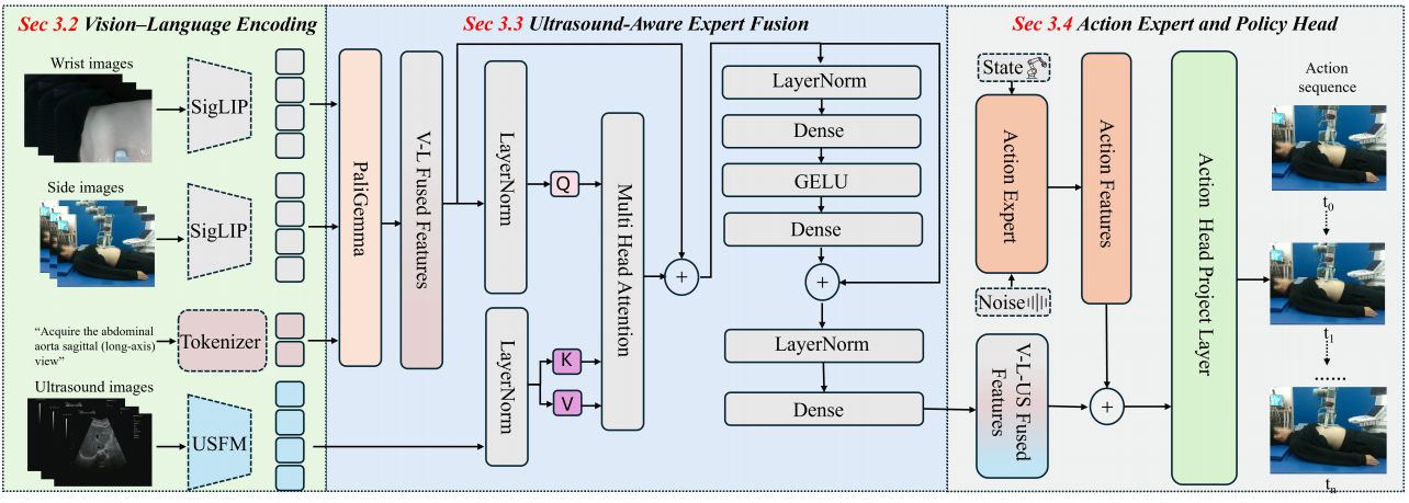 US-VLA: An Ultrasound Vision-Language-Action Model for Embodied Abdominal Scanning